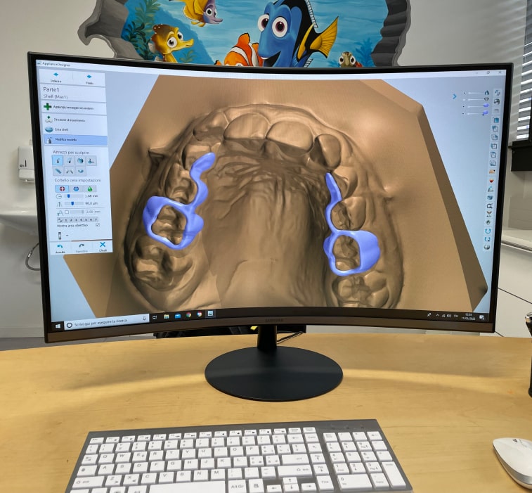 Tecnologia CAD-CAM e saldatrice laser in laboratorio